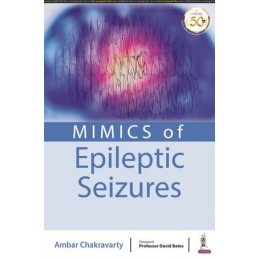 MIMICS of Epileptic Seizures