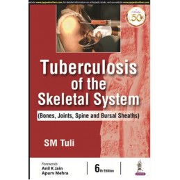 Tuberculosis of the...