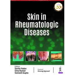 Skin in Rheumatologic Diseases