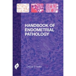 Handbook of Endometrial...