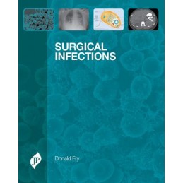 Surgical Infections