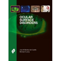 Ocular Surface Disorders