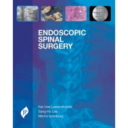 Endoscopic Spinal Surgery