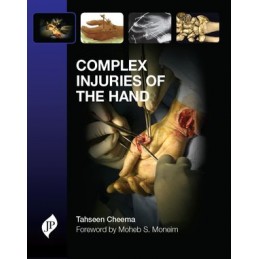 Complex Injuries of the Hand