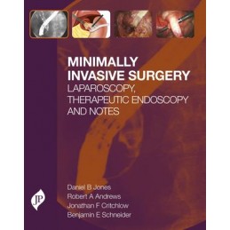 Minimally Invasive Surgery:...