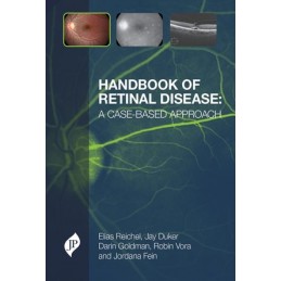 Handbook of Retinal...