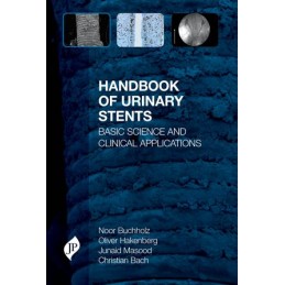 Handbook of Urinary Stents:...