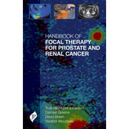 Handbook of Focal Therapy for Prostate and Renal Cancer