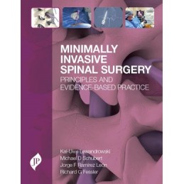 Minimally Invasive Spinal...