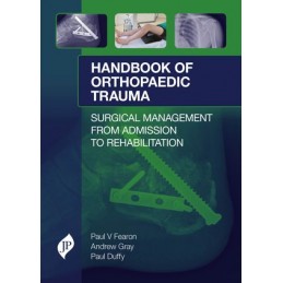Handbook of Orthopaedic Trauma: Surgical Management from Admission to Rehabilitation