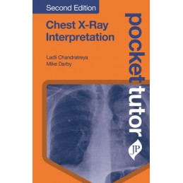 Pocket Tutor Chest X-Ray Interpretation: Second Edition