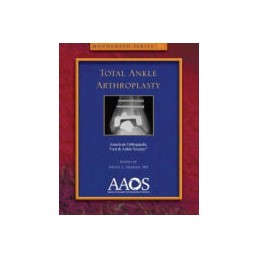 Total Ankle Arthroplasty