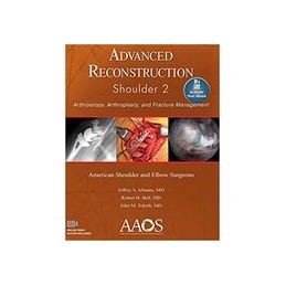 Advanced Reconstruction: Shoulder 2: Arthroscopy, Arthroplasty, and Fracture Management