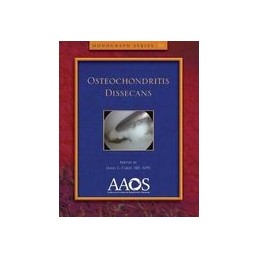 Osteochondritis Dissecans