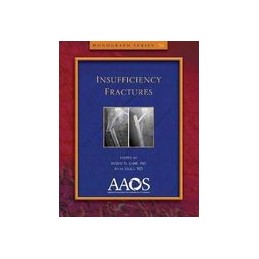 Insufficiency Fractures