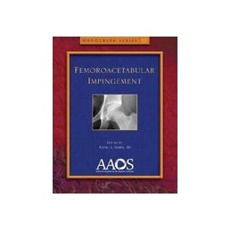 Femoroacetabular Impingement