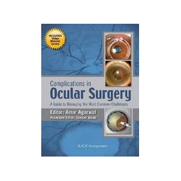Complications in Ocular Surgery: A Guide to Managing the Most Common Challenges