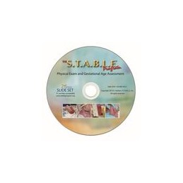 The S.T.A.B.L.E. Program:  Physical Exam/Gestational Age Assessment Slides (DVD)