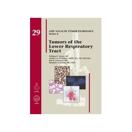 Tumors of the Esophagus and Stomach (AFIP Atlas of Tumor Pathology， Series 4，) Odze， Robert D.、 Montgomery， Elizabeth A.、 Wang， Helen H.、 Lauwers， Gregory Y.、 Greenson M.D.， Joel K.、 Carneiro， F?tima;OdzeRobertD