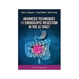Advanced Techniques for Endoscopic Resection in the GI Tract