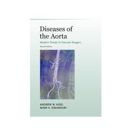 Diseases Of The Aorta