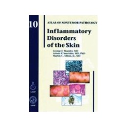 Inflammatory Disorders of...