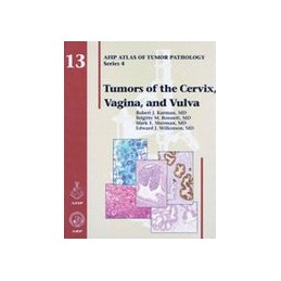 Tumors of the Cervix,...