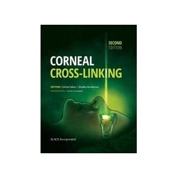 Corneal Cross-Linking