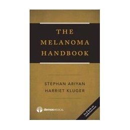 The Melanoma Handbook