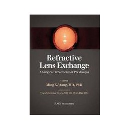 Refractive Lens Exchange: A...