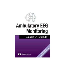 Ambulatory EEG Monitoring
