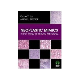 Neoplastic Mimics in Soft...