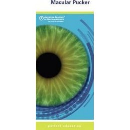 Macular Pucker