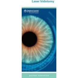 Laser Iridotomy