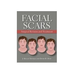 Facial Scars: Surgical...