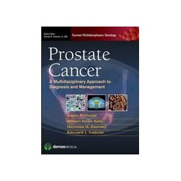 Prostate Cancer: A...