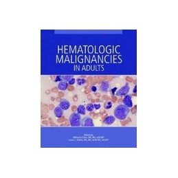 Hematologic Malignancies in...