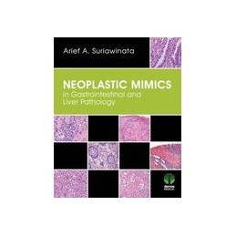 Neoplastic Mimics in...