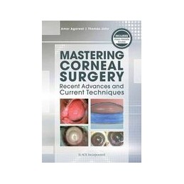 Mastering Corneal Surgery:...
