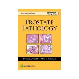 Prostate Pathology