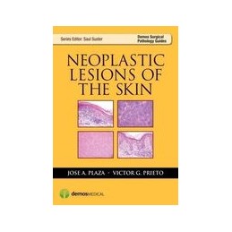 Neoplastic Lesions of the Skin