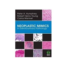 Neoplastic Mimics in Genitourinary Pathology