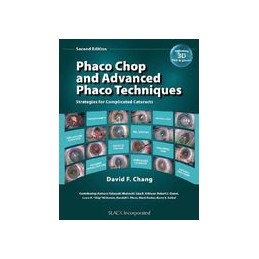 Phaco Chop and Advanced...