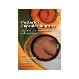 Posterior Capsular Rupture:...