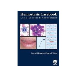 Hemostasis Casebook: Lab...