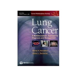 Lung Cancer: A...