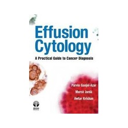 Effusion Cytology: A...