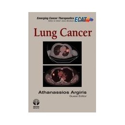 Lung Cancer