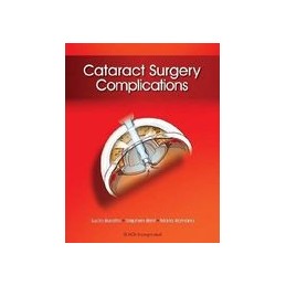 Cataract Surgery Complications