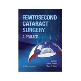 Femtosecond Cataract...